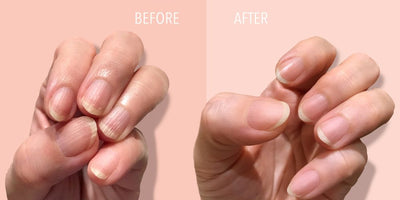 How To Get Rid Of Nail Ridges: Step-by-Step