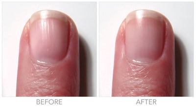 Fortifying Ridge Filler For Flawless Nails | Nail Care | LONDONTOWN